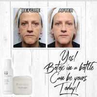 Face Lift with Activator