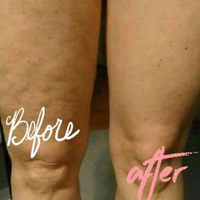 AGELOC® Dermatic Effects Body Contouring Lotion