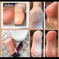 Sole Solution