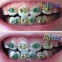 AP 24® Whitening Fluoride Toothpaste